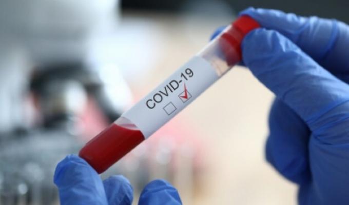 Лабораторно підтверджено ще 22 випадки COVID-19 в області