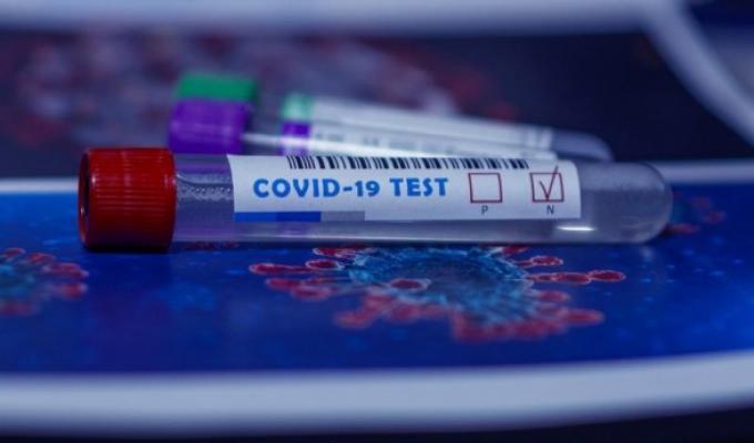 За добу в області зафіксовано 26 нових випадків COVID-19