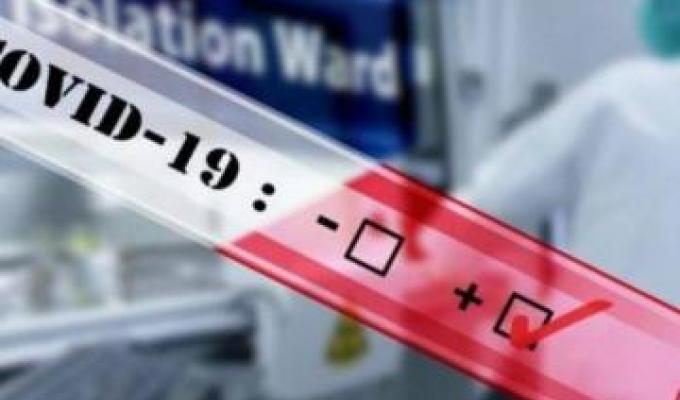 Незважаючи на зусилля лікарів упродовж тижня, врятувати життя захворілій на COVID-19 людині не вдалося