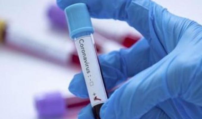 У Луганській області зафіксовано шість нових випадків COVID-19 