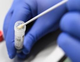 Лабораторно підтверджено 74 нових випадки COVID-19 в області