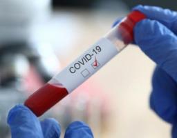 Лабораторно підтверджено ще 22 випадки COVID-19 в області