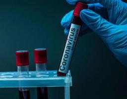 Лабораторно підтверджено 147 нових випадків COVID-19 в області. В Україні – 15 850