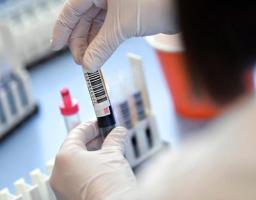 За весь час досліджень в області зафіксовано понад 10 тисяч випадків COVID-19