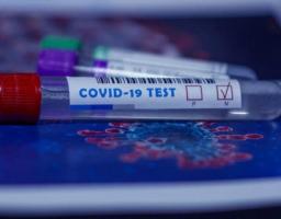 За добу в області зафіксовано 26 нових випадків COVID-19