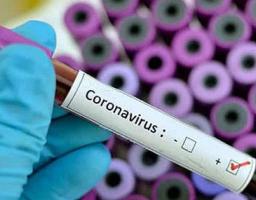 Антирекорди із захворювання на COVID-19 зафіксовані на Луганщині й в Україні: 87 та 5 397 нових випадків
