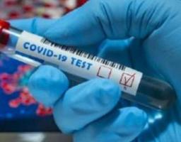В області антирекорд по кількості нових випадків COVID-19: 53 зафіксованих за добу