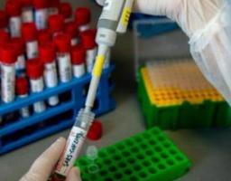 За минулу добу в області підтверджений один новий випадок захворювання на COVID-19. Три людини одужали