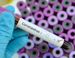 На Луганщині лабораторно підтверджено 14 нових випадків COVID-19