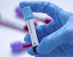 Лабораторно підтверджено 136 нових випадків COVID-19 в області. В Україні черговий антирекорд – 16 218 за добу